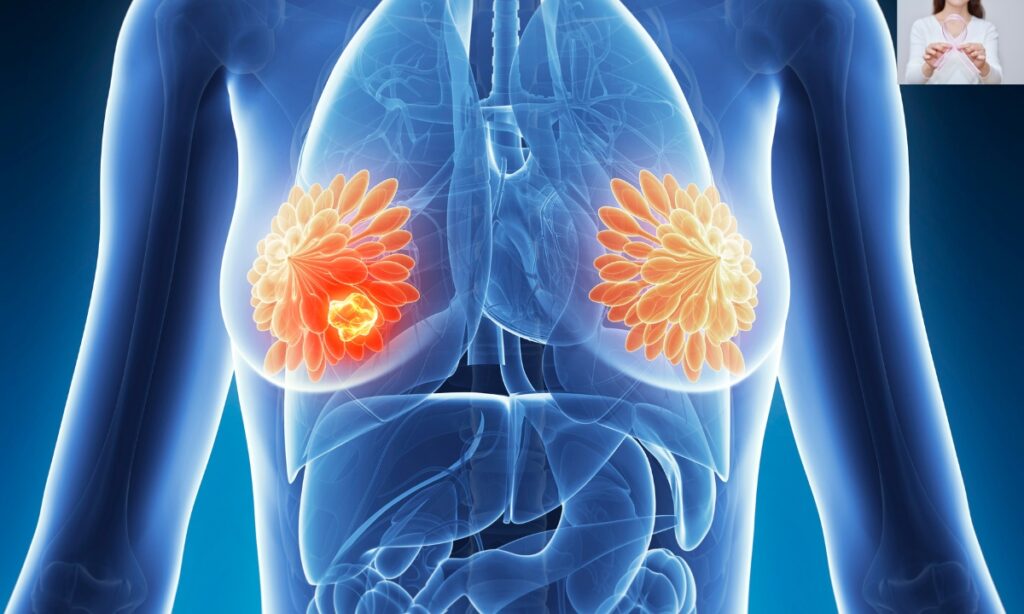 World Breast Cancer Research Day